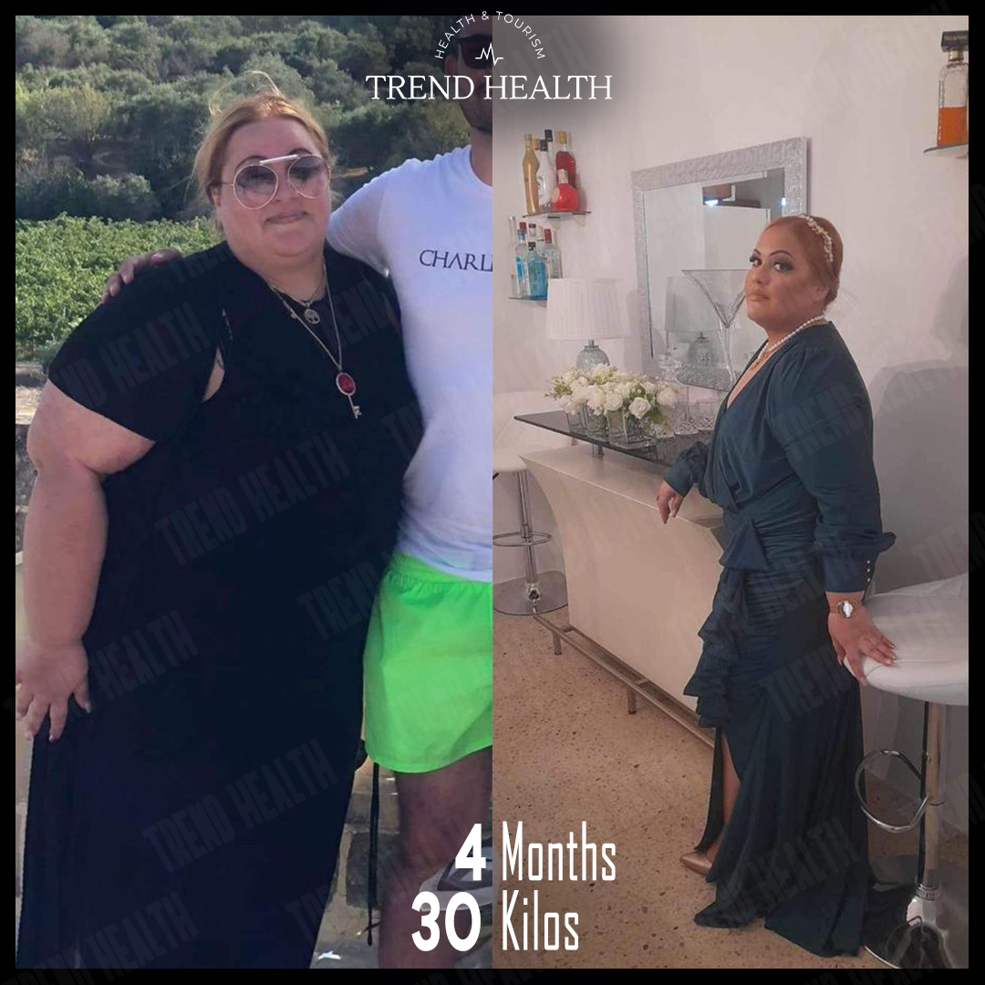 TrendHealthtr's tweet photo. Rosianne ❤️
#beforeandafter #beforafterweightloss #sleevegastrectomy #sleevesurgery #obesitysurgery #weightlossjourney #weightlosstransformation #gastricsleeve #gastricbypass #weightlossurgery #trendhealth #healthtourismturkey #healthtourisminturkey #healthtourism https://t.co/JMCk7ijx99