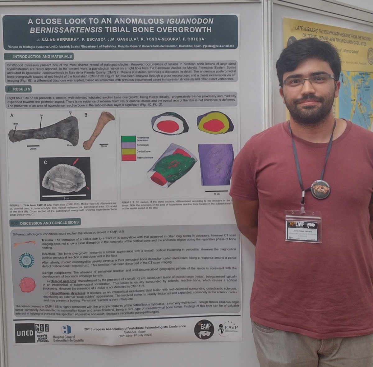 Paleopatologías en #Iguanodon de la Cantera del Mas de la Parreta (#Morella, #Castellón) en el XX Annual Meeting de la <a href="/EAVPalaeo/">EAVP</a> celebrado en #Sabadell (<a href="/eavp2023/">EAVP 2023 Sabadell</a>), a cargo de J. Salas-Herrera (<a href="/JSalasIIDinos/">Javier Salas Herrera</a>) et al:

▶️ godzillin.blogspot.com/2023/07/paleop…
#dinosaur #paleopathology #meeting