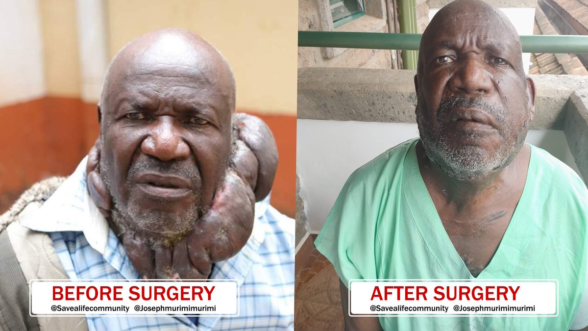 Ghetto_good's tweet photo. Join us in recognizing the transformative leadership of Dr. Joseph  Murimi, whose vision has guided Save a Life Organization to make a  lasting impact. #SaveaLifeOrganization  #DrJosephMurimitransformativeleader https://t.co/7IdcJVeZC0