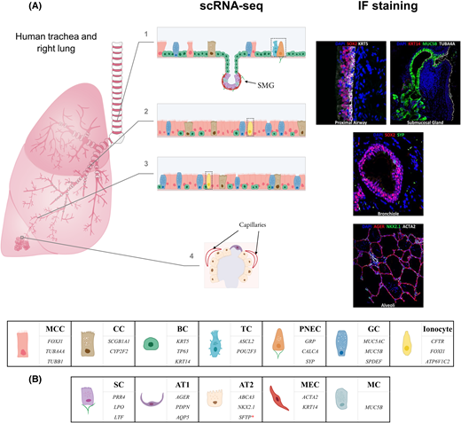 Biochem_Journal's tweet photo. Discover the latest insights from @bingle_colin and colleagues in the new #openaccess review article. Explore the era of single-cell RNA-sequencing, unraveling the diverse types, states, and fates of respiratory epithelial cells. 🧪📝 #RespiratoryResearch https://t.co/zJA6Ga40rW https://t.co/M7D6oj9qCp