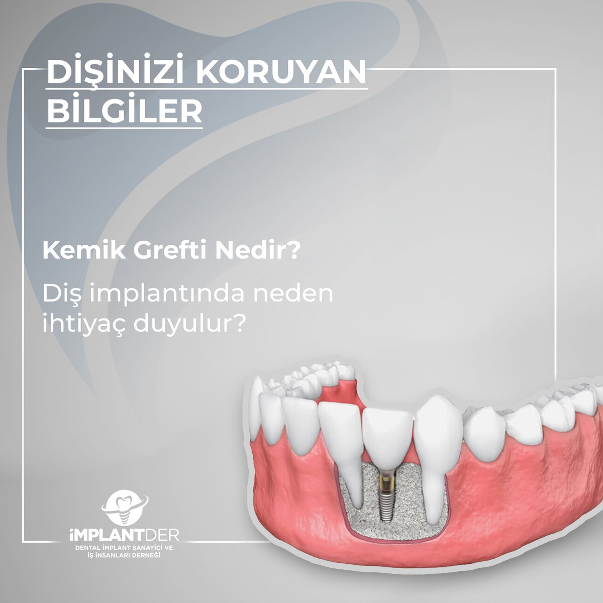 implantder tweet media