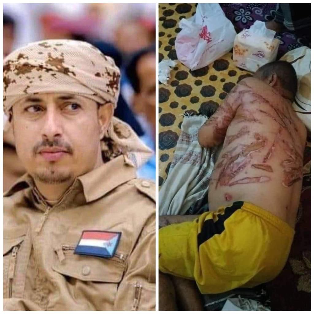 هنا عدن huna aden tweet media