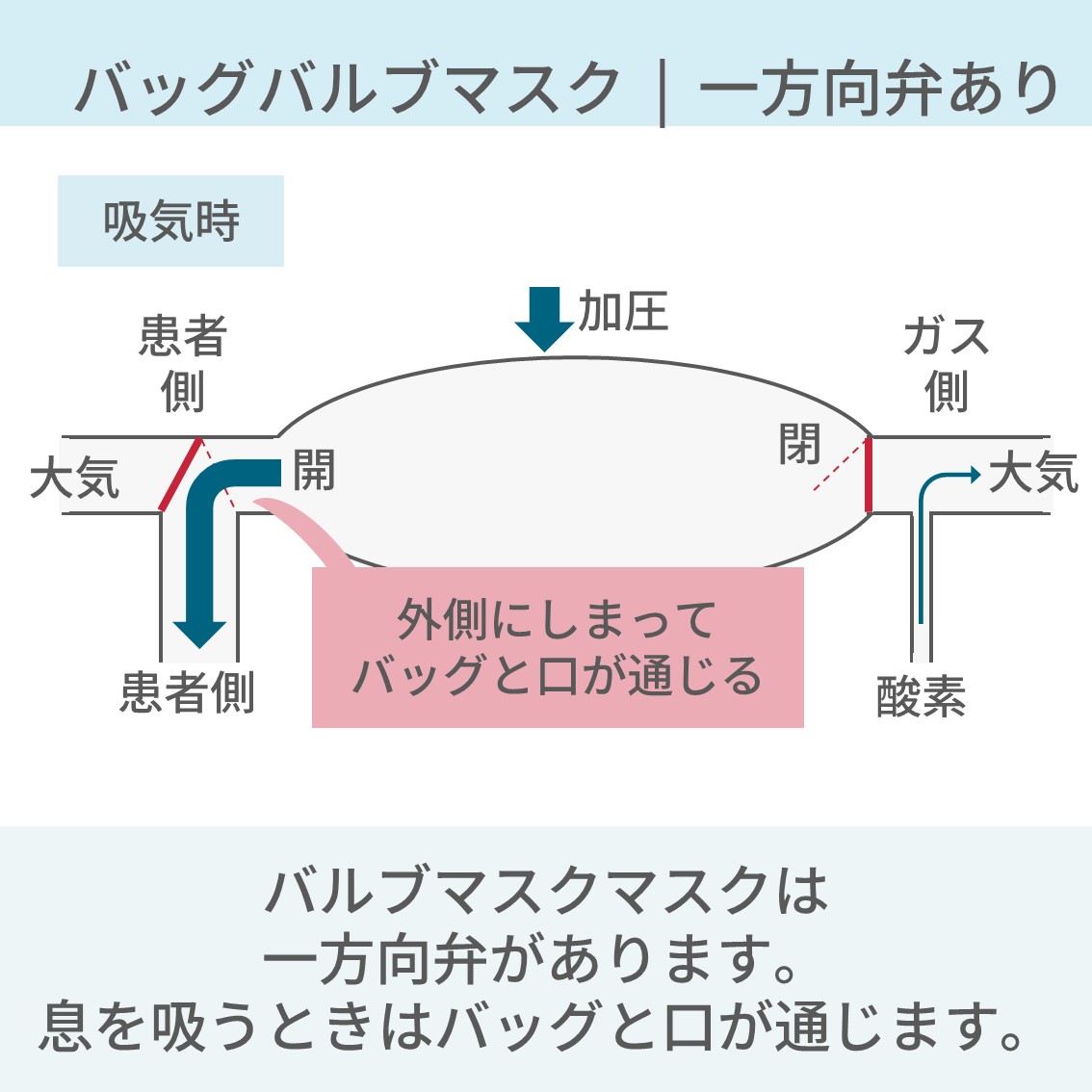 PulmoSheep's tweet photo. 【バッグバルブマスクとジャクソンリース　使い分け】 (1/2) 
↓
続き https://t.co/MrhtddAOnZ