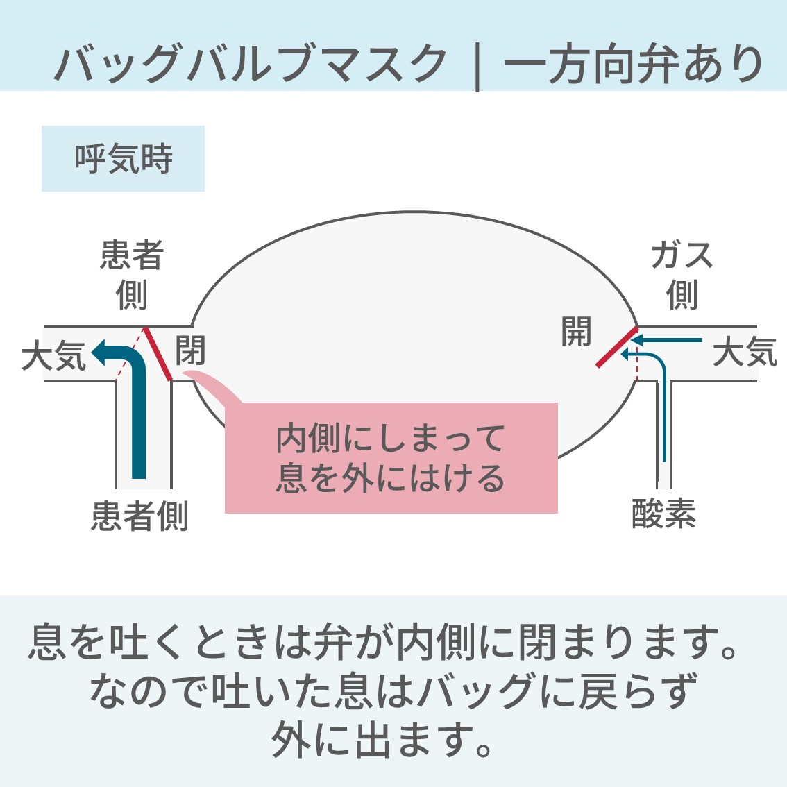 PulmoSheep's tweet photo. 【バッグバルブマスクとジャクソンリース　使い分け】 (1/2) 
↓
続き https://t.co/MrhtddAOnZ
