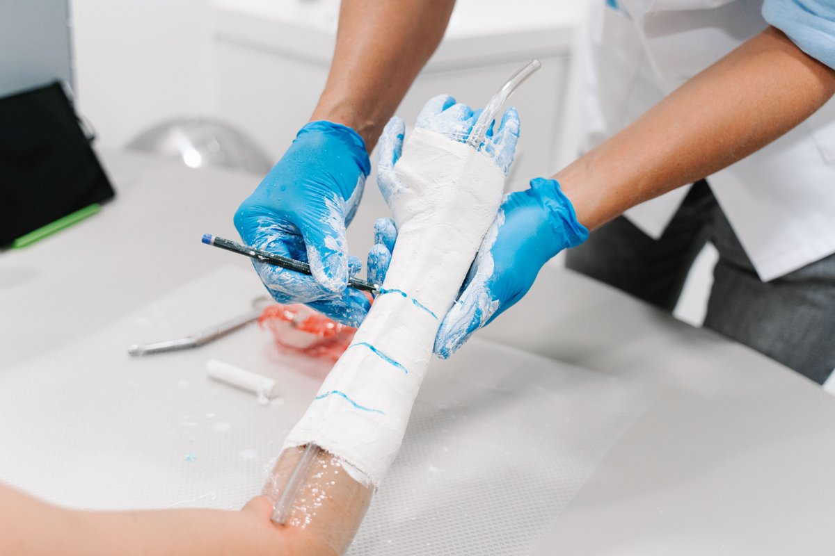 Patients developing skin allergies, pressure sores and even muscle wasting while wearing plaster #casts. Sounds familiar?

Read how <a href="/maartenskliniek/">Sint Maartenskliniek</a> is solving that with #3Dtechnology in our case study available here: bit.ly/3XAWq1H.

#orthopedicdevice #orthopedic