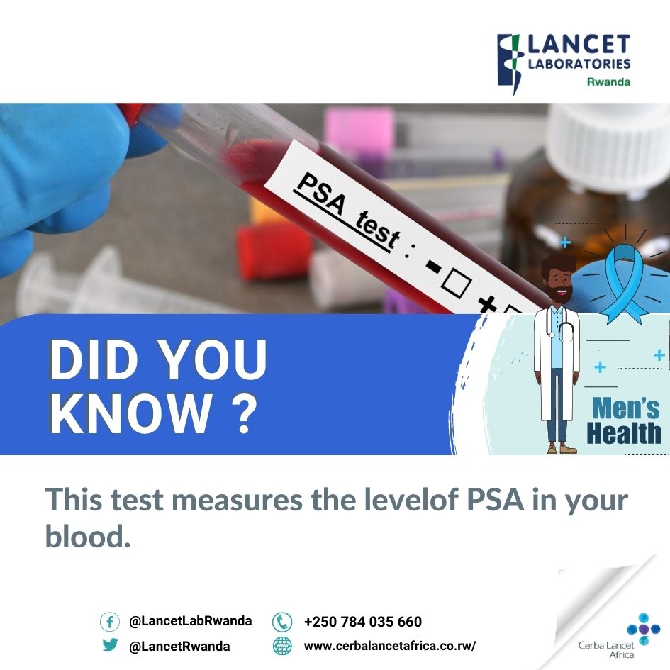 LancetRwanda's tweet image. PSA testing
Prostate cancer is the leading cancer in men in Africa. Globally, men tend to have lower life expectancy compared to women because they are more prone to indulge in high-risk habits such as smoking, drinking, poor diet and violent activities.
#LabTest
#PSAtesting
