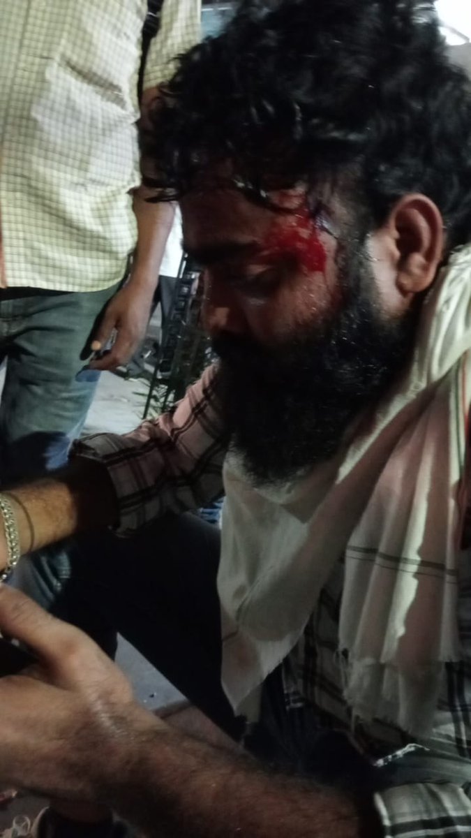 MatinMirza3's tweet photo. राजधानी जयपुर में संविदाकर्मी शिक्षा अनुदेशक संजय खान इसलिए लहूलुहान है कि उसने सरकार से नियमित करने के वादे को पूरा करने की आवाज़ उठाई।
#गहलोत_सरकार_नियमित_करो 
@dsrajpurohit291 @1stIndiaNews @News18Rajasthan @ashokgehlot51 @RafeekKhanInc https://t.co/pwjdscjzUG