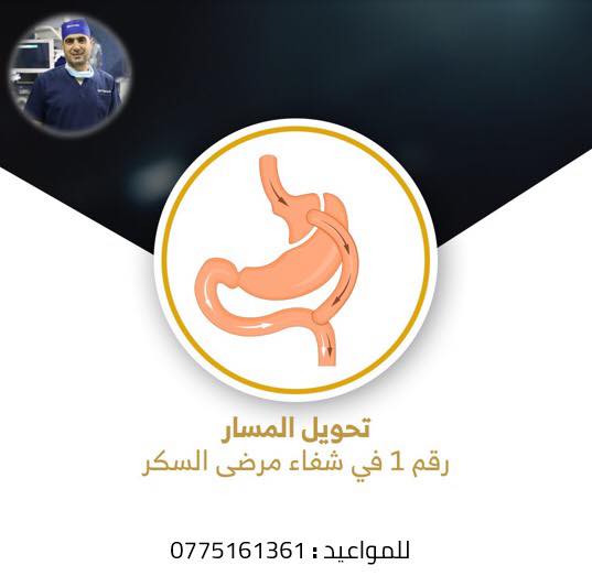 اولا : تعتبر عملية تحويل المسار
من اهم و انجح الحلول
في علاج مشكلة السمنة و السكر

- و أهم ما يميزها : 📷
- تساعد على تقليل نسبه امتصاص الاكل
- تساعد على التخلص من الوزن الزائد
- تساعد في علاج السكر خاصة السكر من الدرجة الثانيه
- تتم العمليه عن طريق المنظار بدون جراحة