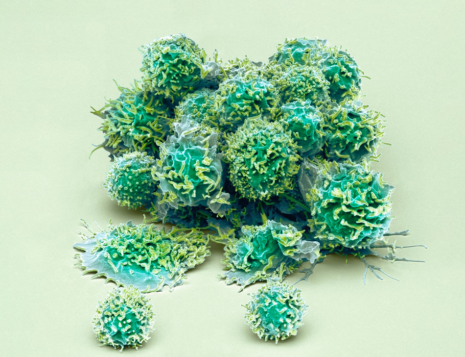 Science Immunology (@sciimmunology) on Twitter photo A new study by <a href="/LouisPerriman/">Louis Perriman</a> <a href="/DanielPellicci/">Daniel Pellicci</a> characterizes a less-studied group of unconventional T cells, establishing that they can develop in the thymus after birth.
Learn more: scim.ag/3nm A new study by <a href="/LouisPerriman/">Louis Perriman</a> <a href="/DanielPellicci/">Daniel Pellicci</a> characterizes a less-studied group of unconventional T cells, establishing that they can develop in the thymus after birth.
Learn more: scim.ag/3nm