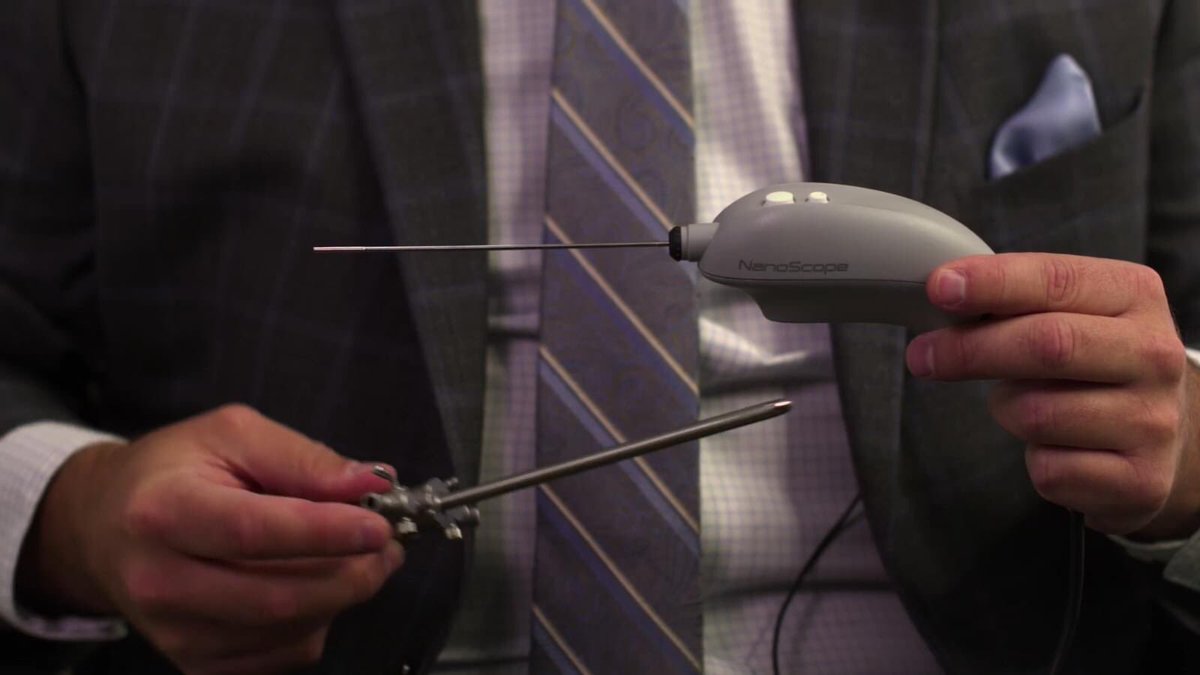 MUSOMWV's tweet photo. A team of researchers from our orthopaedic department found the use of a needle-sized scope known as a nanoscope during a partial meniscectomy to be associated with decreased pain and improved patient-outcome scores at two weeks after surgery.
Read more: https://t.co/IEQoGoDjqL https://t.co/itYgVkdD8R