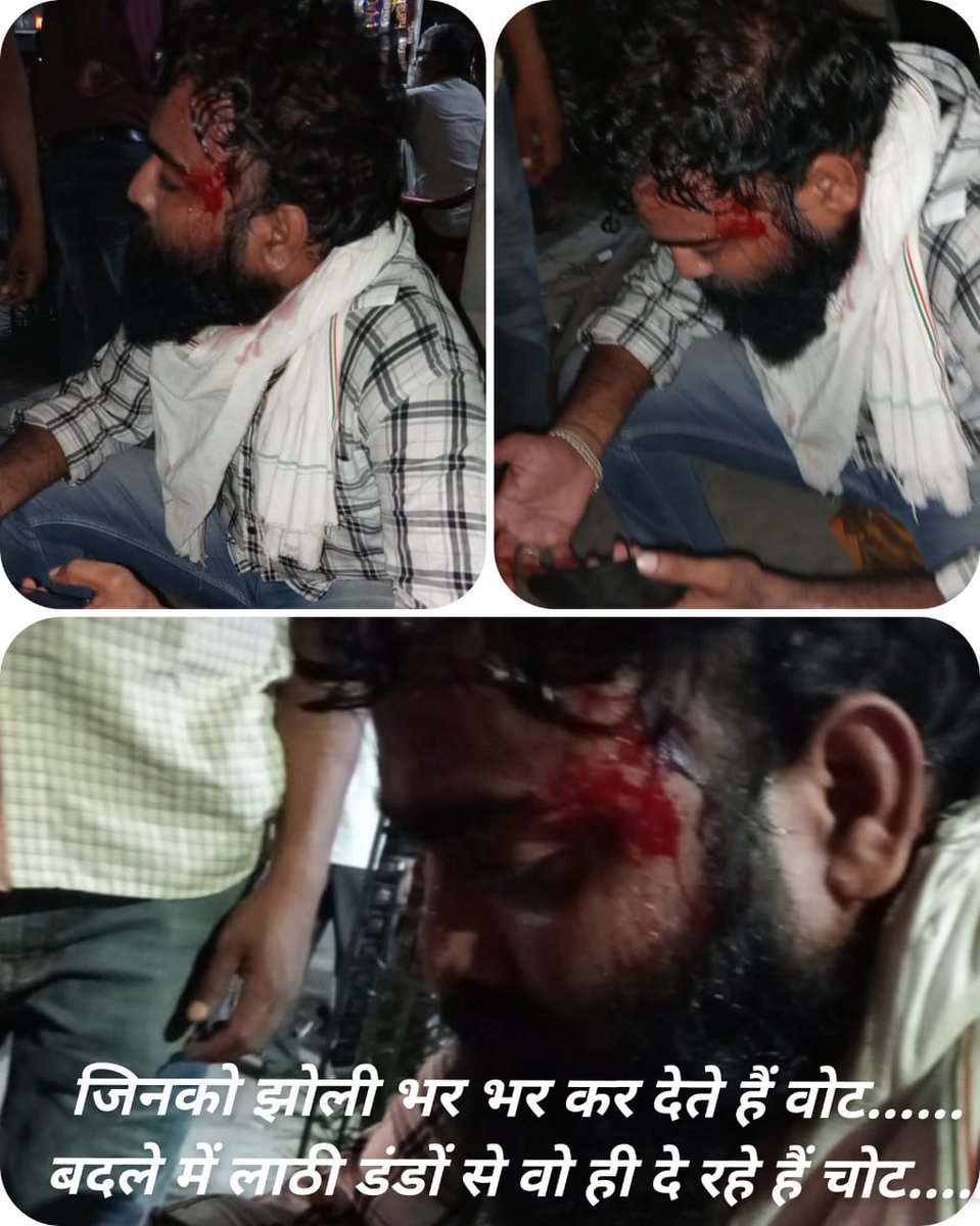 yunuskhan20's tweet photo. राजधानी जयपुर में संविदाकर्मी संजय खान इसलिए लहूलुहान है कि उसने सरकार से नियमित करने के जनघोषणापत्र वादे को पूरा करने की आवाज़ उठाई।
#गहलोत_सरकार_नियमित_करो 
@dsrajpurohit291 @1stIndiaNews @News18Rajasthan @ashokgehlot51 @RafeekKhanInc https://t.co/CbxIWJjwGV