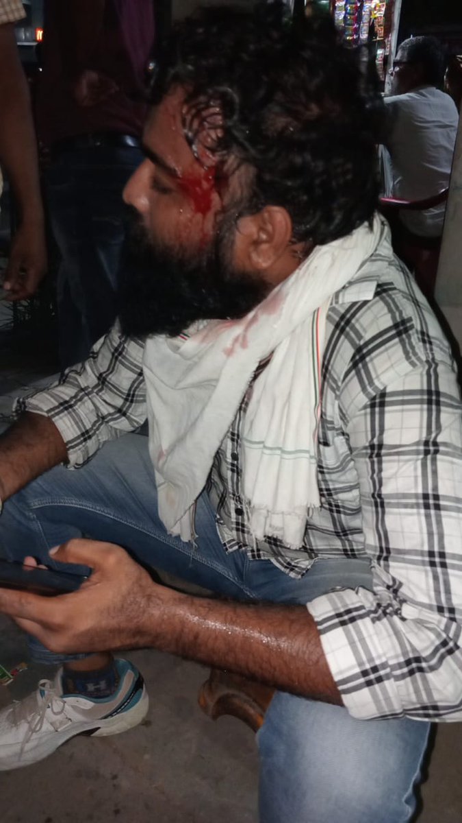 Sahib09308775's tweet photo. ये है कांग्रेस सरकार का न्याय नियमितीकरण की मांग उठाने पर लाठिया मारी गई। आने वाले चुनाव मे कांग्रेस का सारा नशा उतार देगा ये संविदा कर्मी 
मदरसा पैरा टीचर्स साथी संजय भाई हुआ घायल @ashokgehlot51 @RajCMO @priyankagandhi @RahulGandhi @Prashant_Kharge @ShayarImran @_lokeshsharma https://t.co/vhBlPzuU7r