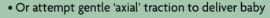 Can anyone quantify 'gentle' in relation gentle axial traction for me regarding the management of #shoulderdystocia by #ambulance clinicians. Any research papers with numbers would be great. :) #FOAmed #Paramedic
