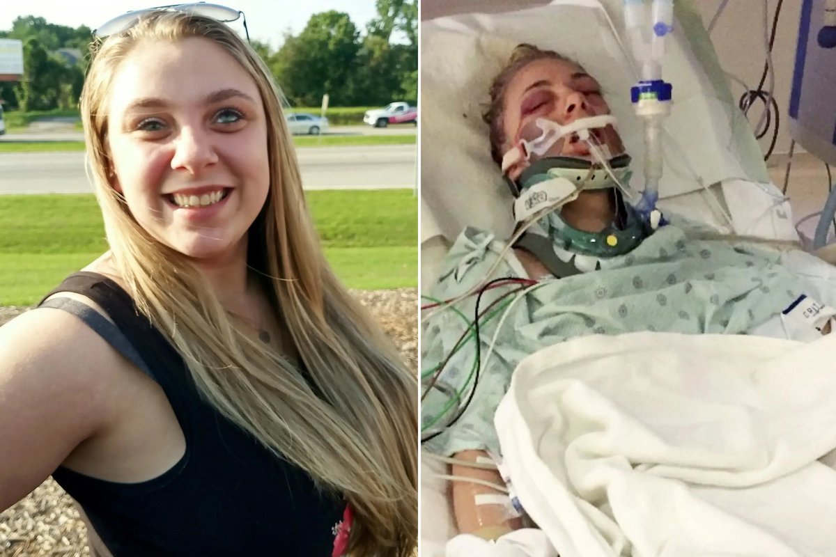 MorbidKnowledge's tweet photo. In February 2018, Kaylee Muthart ripped out her own eyes, and squished them with her hands during a meth induced psychotic episode. 

Muthart had been awake for almost 48 hours, snorting and injecting a concoction of tainted methamphetamine. https://t.co/zc1b4qeS6p