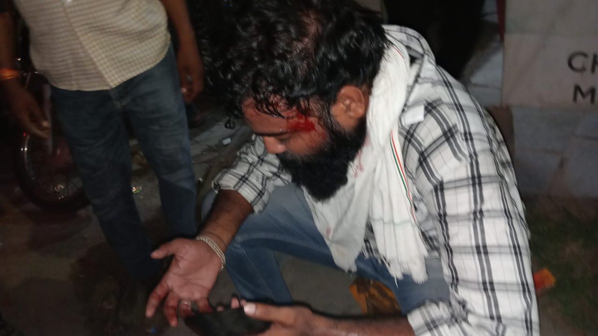 Rashid4all's tweet photo. ये है कांग्रेस सरकार का न्याय नियमितीकरण की मांग उठाने पर लाठिया मारी गई। आने वाले चुनाव मे कांग्रेस का सारा नशा उतार देगा ये संविदा कर्मी 
मदरसा पैरा टीचर्स साथी संजय भाई हुआ घायल @ashokgehlot51 @RajCMO @priyankagandhi @RahulGandhi @Prashant_Kharge @ShayarImran @_lokeshsharma https://t.co/TVgtTLTajv