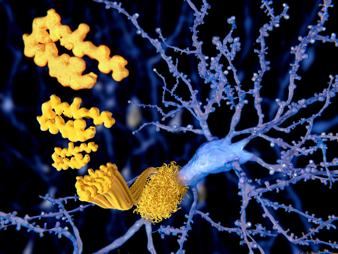 At least two possible CRISPR-based therapies for Alzheimer’s  were reported this week at <a href="/alzassociation/">Alzheimer's Association</a>  #AAIC23. One aims to reduce the impact of APOE-e4. The other affects the brain’s production of beta amyloid. Learn more: ow.ly/L1B450PeeYH