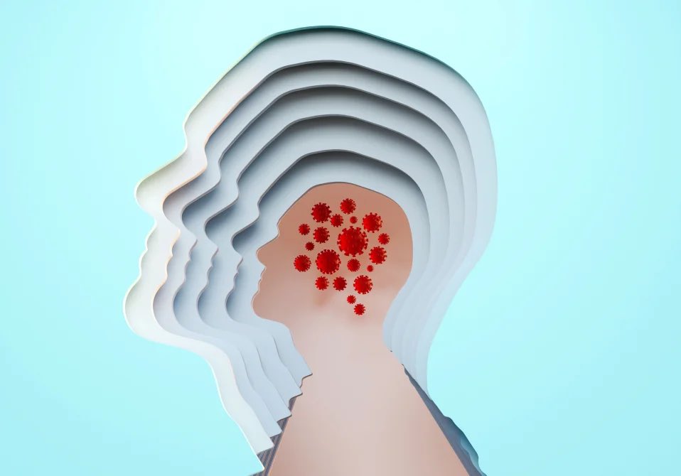 RWittenbrink's tweet photo. Wissenschaftler beginnen gerade erst, die Wirkung von #COVID19 auf das Gehirn zu verstehen

„Kognitiver Verfall, Veränderungen der Größe und Struktur des Gehirns, Depressionen und Selbstmordgedanken, Zittern, Krampfanfälle, Gedächtnisverlust und…

#LongCovid #Corona #SARSCoV2 https://t.co/nFwRUWWubw