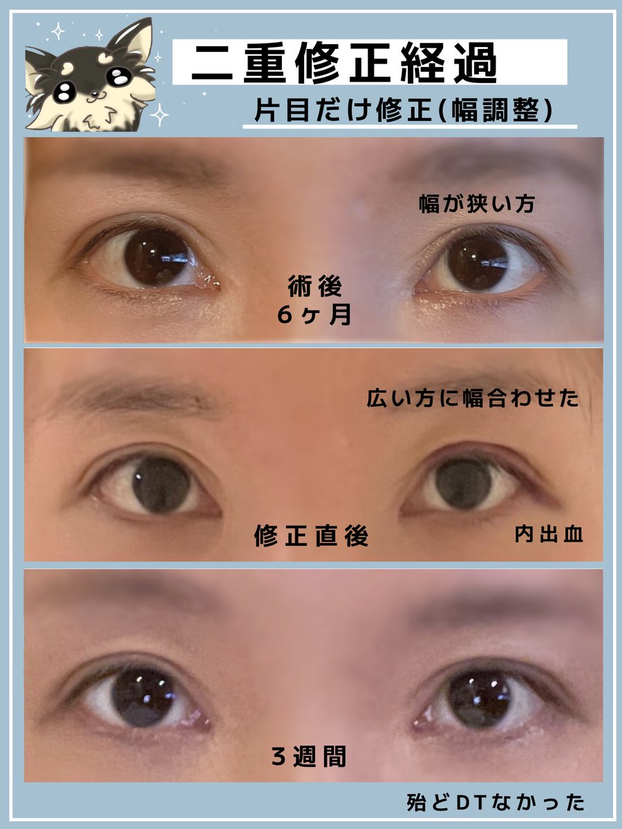 河崎 ジュリ ┊💉整形人生. tweet media