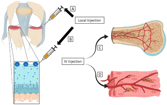 Encyclopedia_X's tweet image. 📰 Route of Administration in the #MusculoskeletalSystem

👨‍🎓 Brandon Vorrius, Zhen Qiao, Jonathan Ge, Qian Chen

🔗 encyclopedia.pub/entry/46855