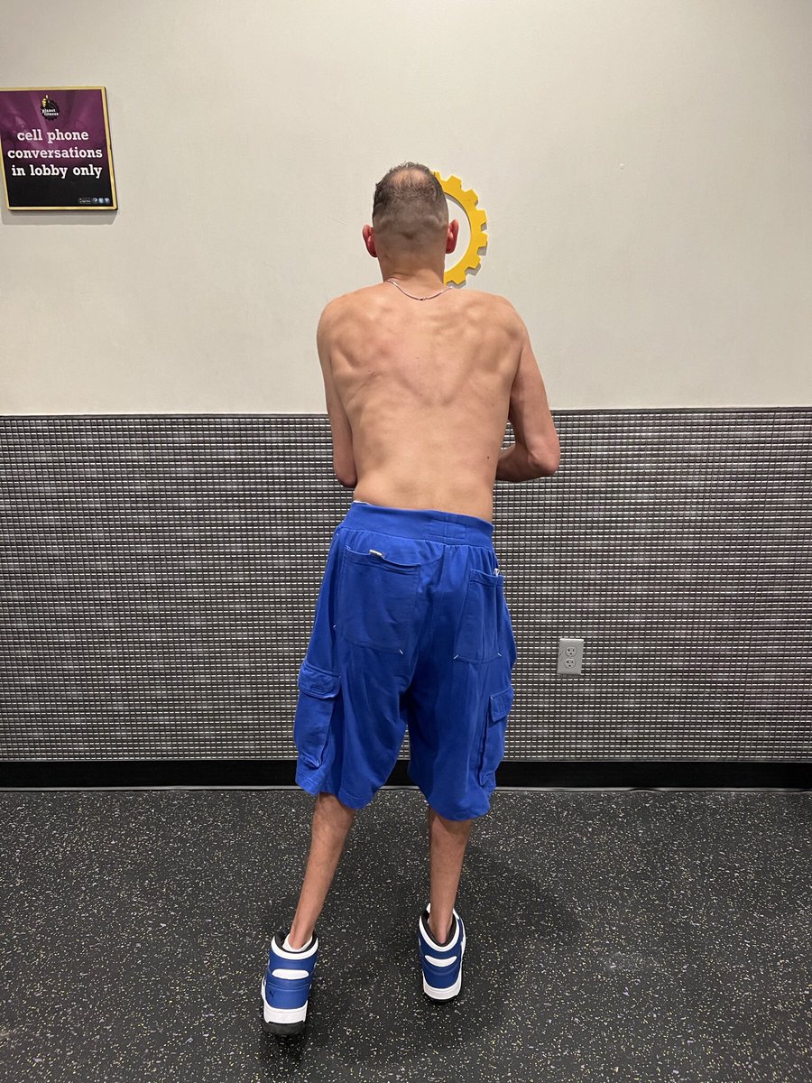 jamwh2012's tweet image. Posing for the camera July 2023 progression photos ♋️ #posingforthecamera📷 #progresspictures #cerebralpalsywarrior #fullbodyworkout #bodybuilding #cerebralpalsywarrior #cerebralpalsyawareness 
#cerebralpalsyawareness #cerebralpalsyinfluencer #cerebralpalsylife