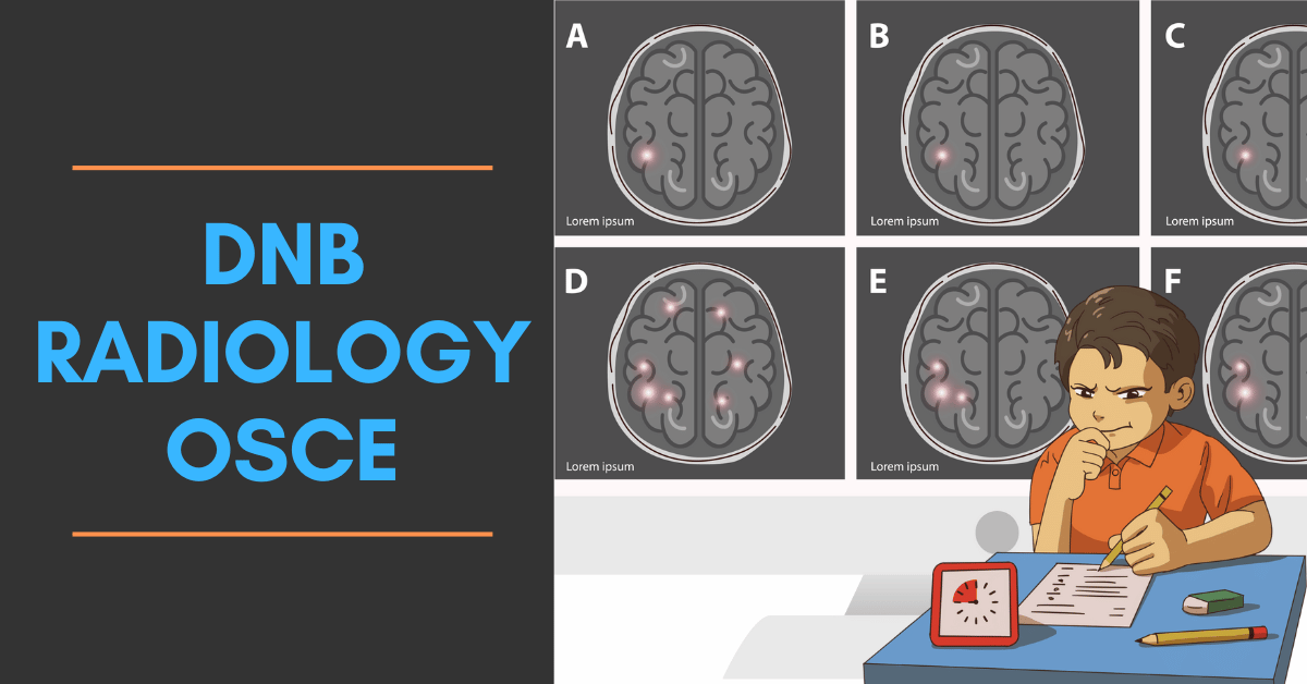 🔗 radiogyan.com/guides/dnb-rad…

📷 New article alert! Check out these helpful tips to ace the DNB #Radiology OSCE Exam. From studying strategies to what to expect during the exam, this article has got you covered. 

#DNBRadiology #OSCEExamTips