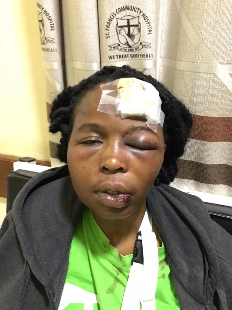 SemaUkweliKenya's tweet image. My name is Annete Githinji and I want to share with you about the day that I almost lost my life. It was on 2nd November 2022, when my then ex-boyfriend Billy Mudavadi Kisia was staying at my apartment in Clayworks, Kasarani area.

We were still on good terms at the time and…