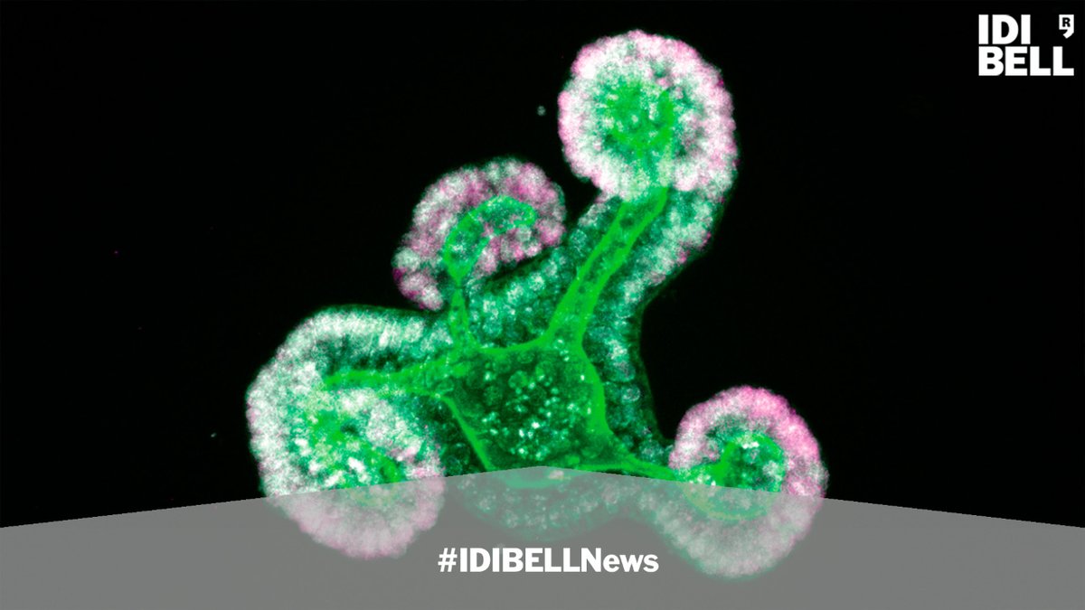 IDIBELL (@idibell_cat) on Twitter photo 🆕Descriuen els mecanismes que controlen la transició de les cèl·lules mare intestinals de fetals a adultes
L'estudi liderat per <a href="/reNEW_Global/">reNEW</a>, amb la participació <a href="/idibell_cat/">IDIBELL</a> i <a href="/p_cmrc/">Programa de Medicina Regenerativa de Catalunya</a>, s'ha publicat en dos articles a <a href="/ScienceAdvances/">Science Advances</a>
#IDIBELLnews
➡️bit.ly/3pQTEsI 🆕Descriuen els mecanismes que controlen la transició de les cèl·lules mare intestinals de fetals a adultes
L'estudi liderat per <a href="/reNEW_Global/">reNEW</a>, amb la participació <a href="/idibell_cat/">IDIBELL</a> i <a href="/p_cmrc/">Programa de Medicina Regenerativa de Catalunya</a>, s'ha publicat en dos articles a <a href="/ScienceAdvances/">Science Advances</a>
#IDIBELLnews
➡️bit.ly/3pQTEsI