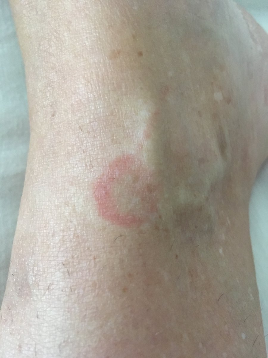 Incubator for Advanced Surgical Technology tweet media