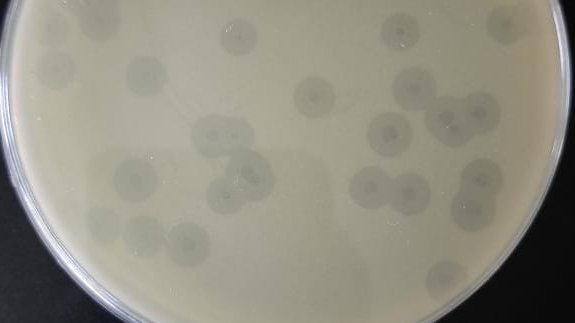 MutaiIvy's tweet photo. What a #Phagy Tuesday with #halo-ing phages over here @PhagesIPR with team @justnyongs @abukanyang @Juma_angie 
#phage4AMR #phagehunt https://t.co/Js5NSjDPD8
