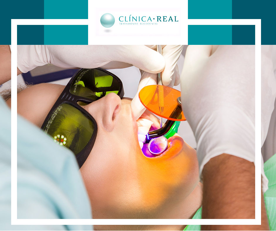 Obtén una sonrisa brillante con nuestro tratamiento de #blanqueamiento dental. Usamos tecnología avanzada para resultados rápidos y que duran mucho tiempo 👌

➡ ¡Ponte en contacto con nosotros!

☎ 926 923 990 | 📍 C/ Obispo Esténaga, 6 - Ciudad Real