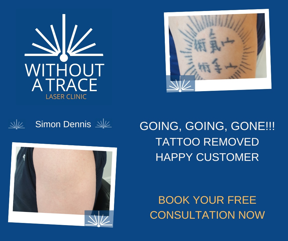**Say goodbye to your unwanted tattoo with laser tattoo removal. Book your free consultation today!**

#lasertattooremoval #tattooremoval #freeconsultation