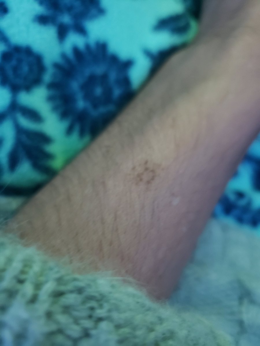 MansfieldBenz's tweet image. #TheOrginalConversation 
#LadyLogic 

To the know grown gentleman that was interested in puddles too: 
Ancient-John was there and you are of his type. Guess what, Man: 
Worms leave a dot pattern, it&apos;s stenographer-ish looking...Stegoknography;