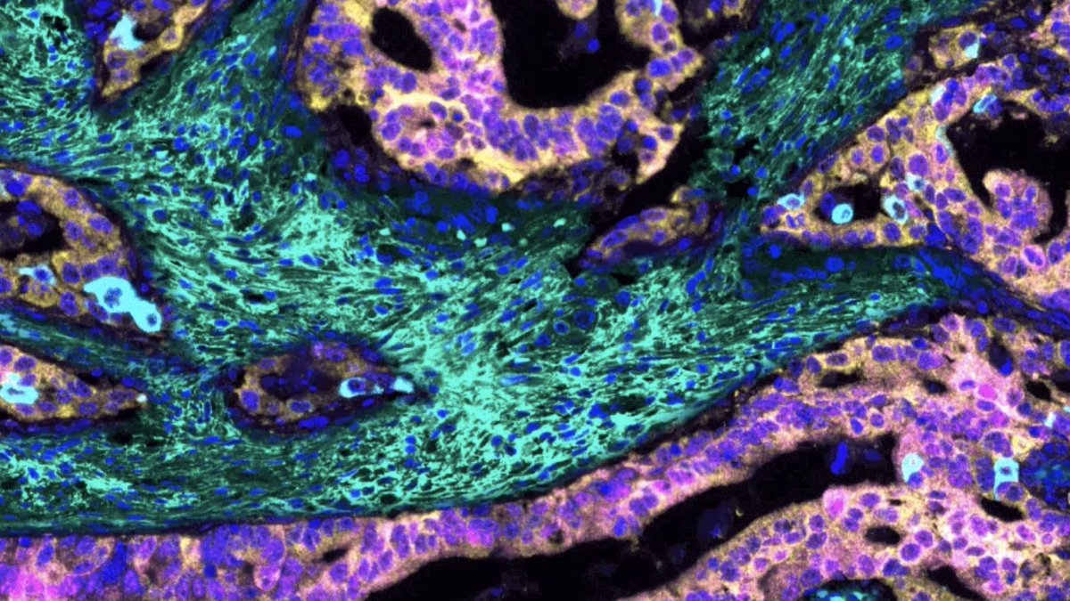 Weill Cornell Medicine Pathology tweet media