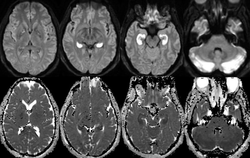 Daniel Gewolb, MD tweet media