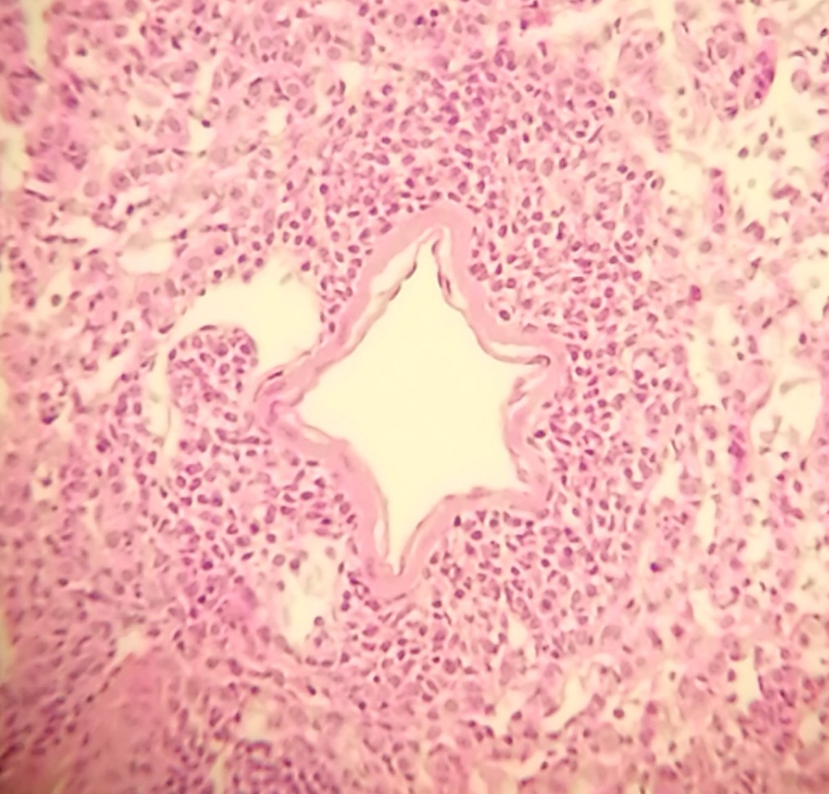 JJohnsonLab's tweet photo. This blood vessel is a star! ⭐️ We recently held another #outreach #biology day with local secondary school students to help them explore science in fun ways! https://t.co/2hXPPlQOPF