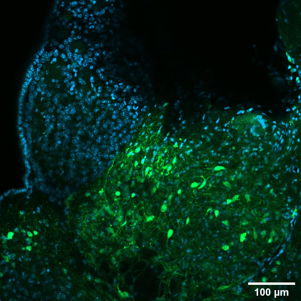 pirizlab's tweet photo. Un poco más de GCaMP en la Habénula Lateral. Desde la óptica de un aumento 10x y 20x para ver bien de cerca estas increíbles neuronas 🐭🧠💚💙 by @pauospital https://t.co/4kuhVAS1h9