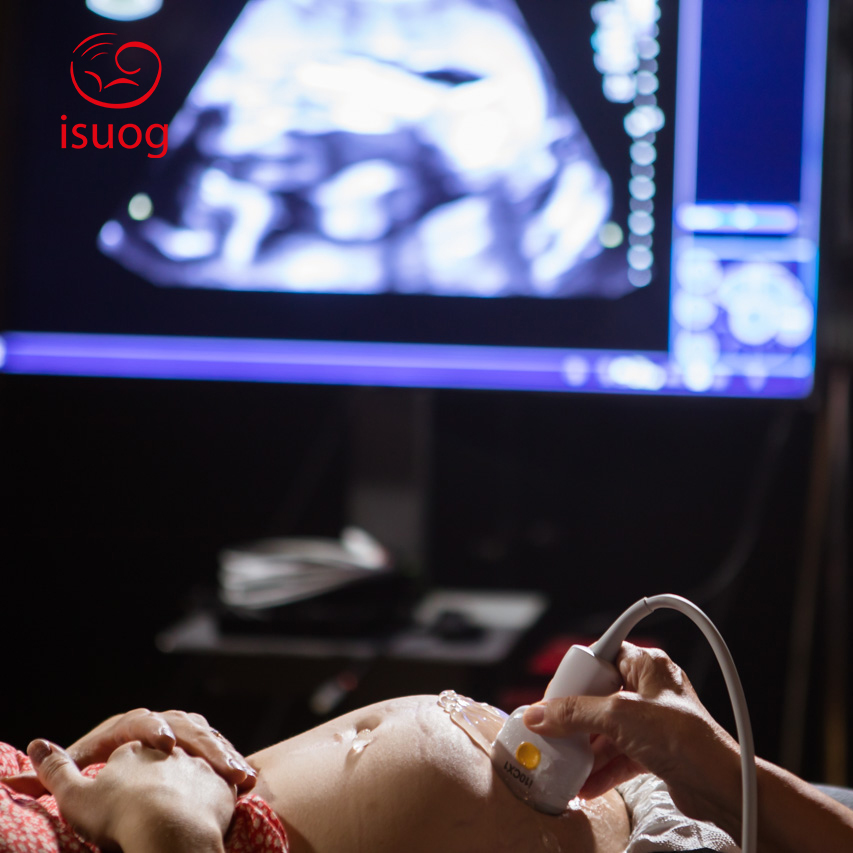ISUOG tweet picture