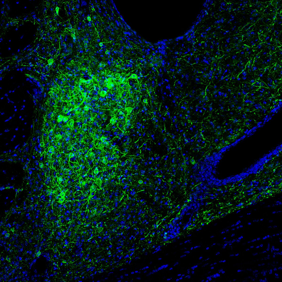 GiardinoLab's tweet image. 🧠Our group is hiring a technician! Come join the lab at Stanford and contribute to our work on the neurobiology of stress, addiction, and sleep/wake regulation. Prior experience with (rodent) behavioral neuroscience research is required. Please RT &amp;amp; share careersearch.stanford.edu/jobs/life-scie…