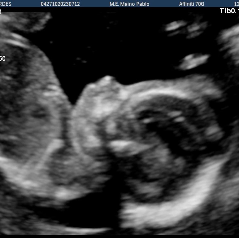 Bebé Fernando💙
Te esperamos con muchas ansias hijo🤰