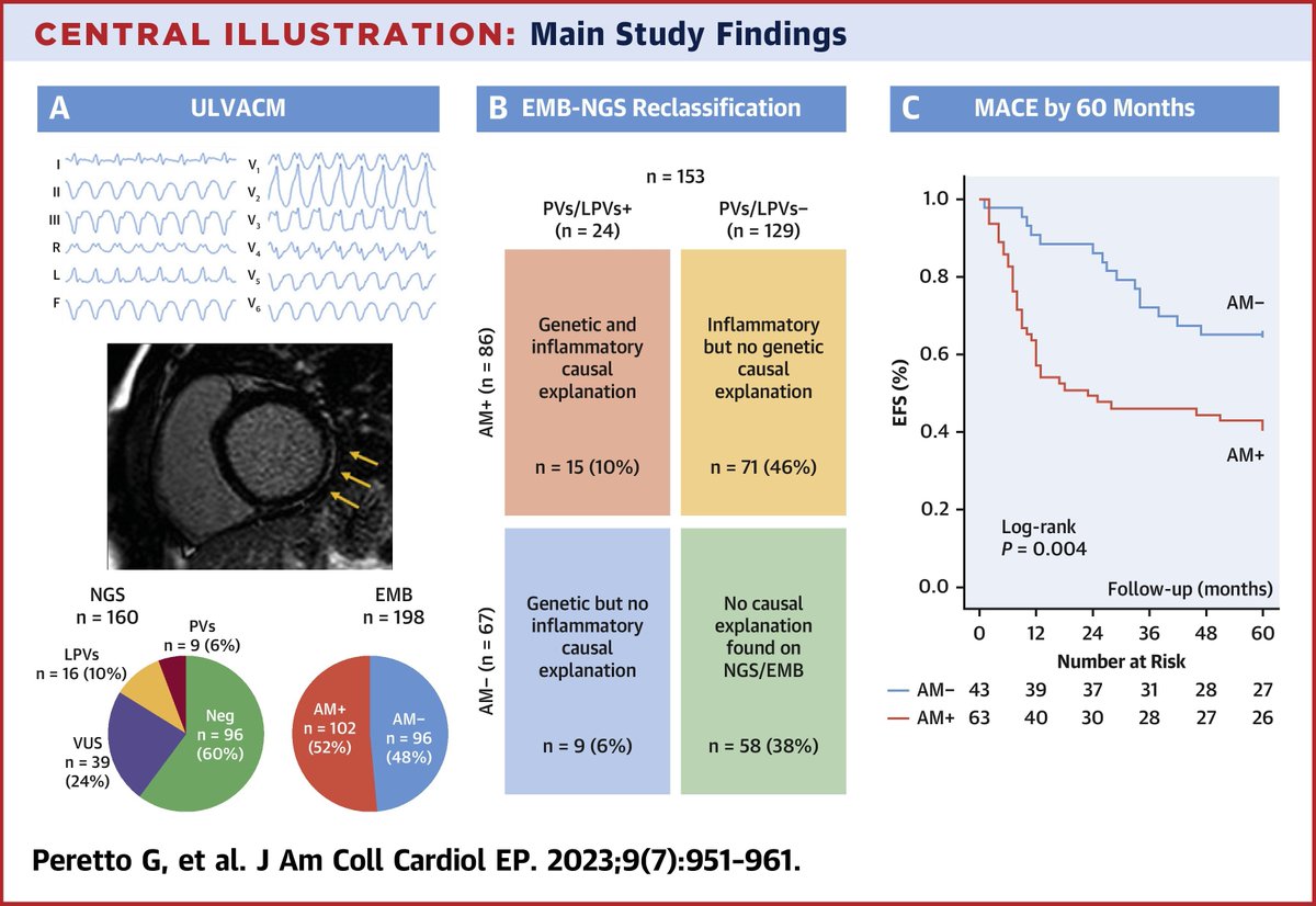 JACC Journals (@jaccjournals) on Twitter photo Dr. <a href="/GiovanniPeretto/">Giovanni Peretto</a>, et al investigate the prognostic value of genetic testing and histology in a cohort of undefined left ventricular arrhythmogenic #cardiomyopathy patients ➡️ bit.ly/3Y4tyz9
#JACCCEP #EPeeps #MACE #CardioTwitter Dr. <a href="/GiovanniPeretto/">Giovanni Peretto</a>, et al investigate the prognostic value of genetic testing and histology in a cohort of undefined left ventricular arrhythmogenic #cardiomyopathy patients ➡️ bit.ly/3Y4tyz9
#JACCCEP #EPeeps #MACE #CardioTwitter