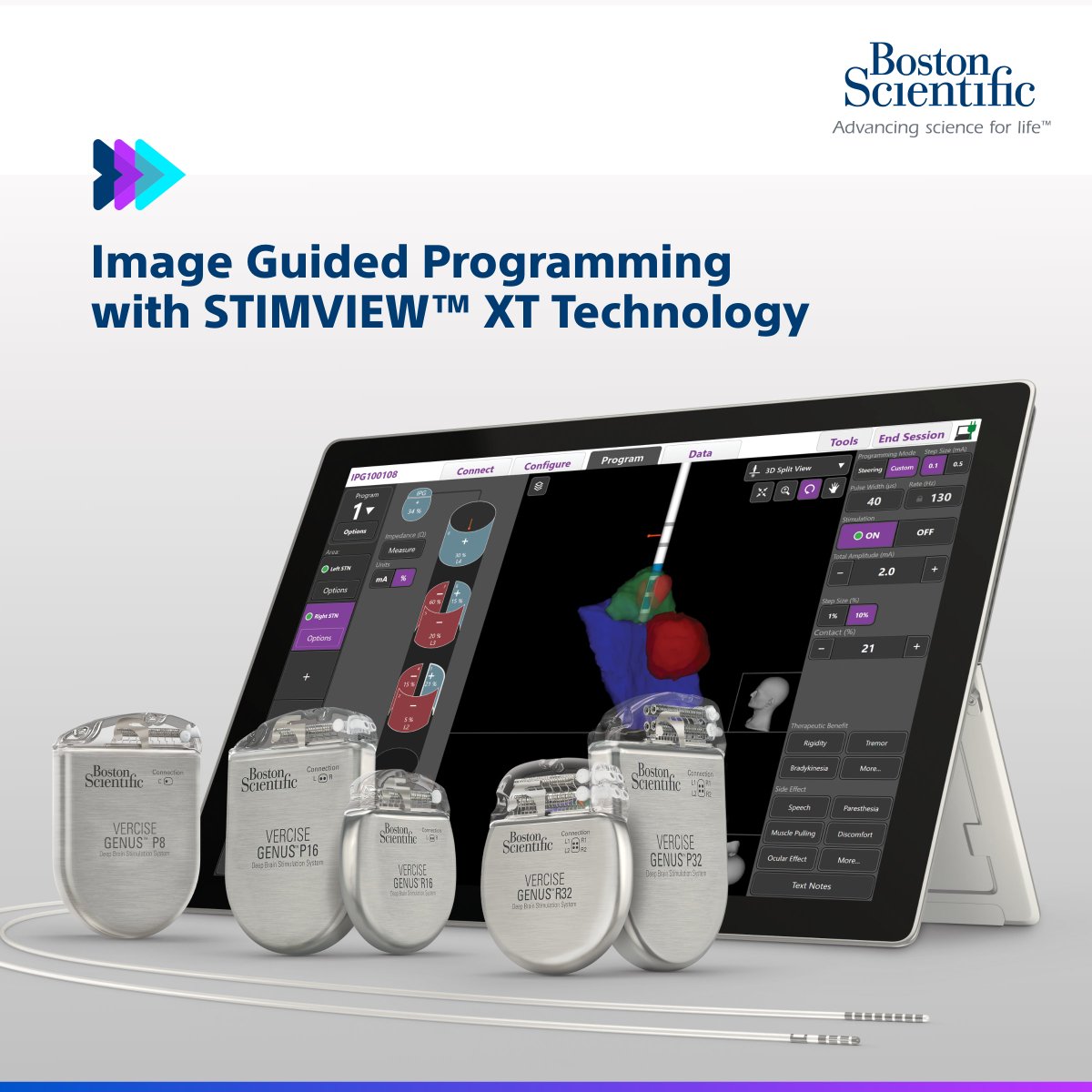 BSCDBS's tweet photo. Did you know clinicians can now, in real time, visualize lead placement and stimulation field modeling in the context of each patient’s specific anatomy, making programming streamlined and efficient with STIMVIEW™XT Technology? https://t.co/9l2p9xRjtL
#stimviewxt #dbs https://t.co/L7diOZZMMz