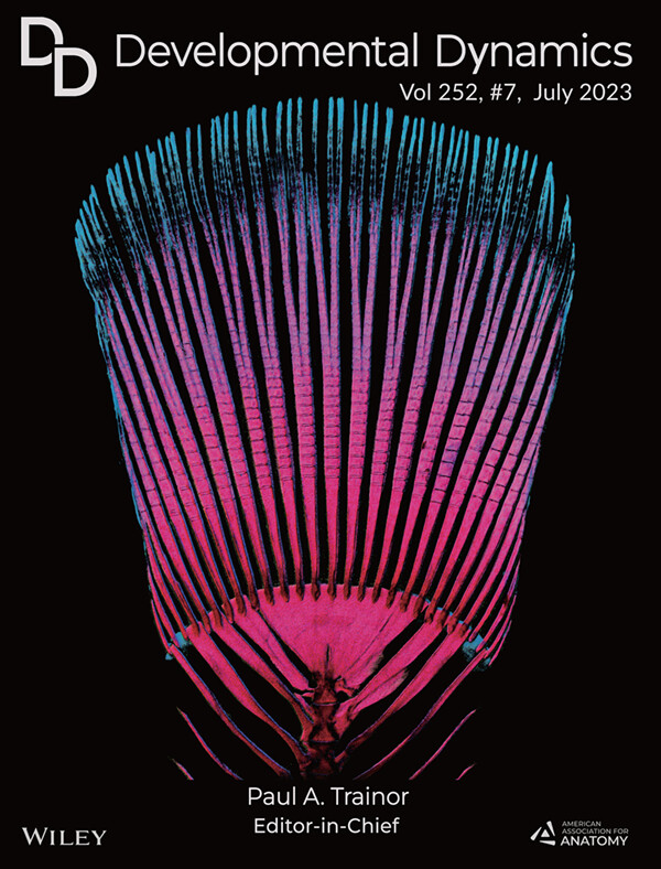 DevelopmentalDy's tweet photo. The Art of Science - Cover of Developmental Dynamics
Alizarin red (#bone) and Alcian blue (#cartilage) staining of the #skeleton of #platyfish. Some principal rays are supported by epichordal bones = unusual anatomy in #teleosts. With thanks to Lana Rees, Désirée König, Jaźwińska https://t.co/MlvIklko8f