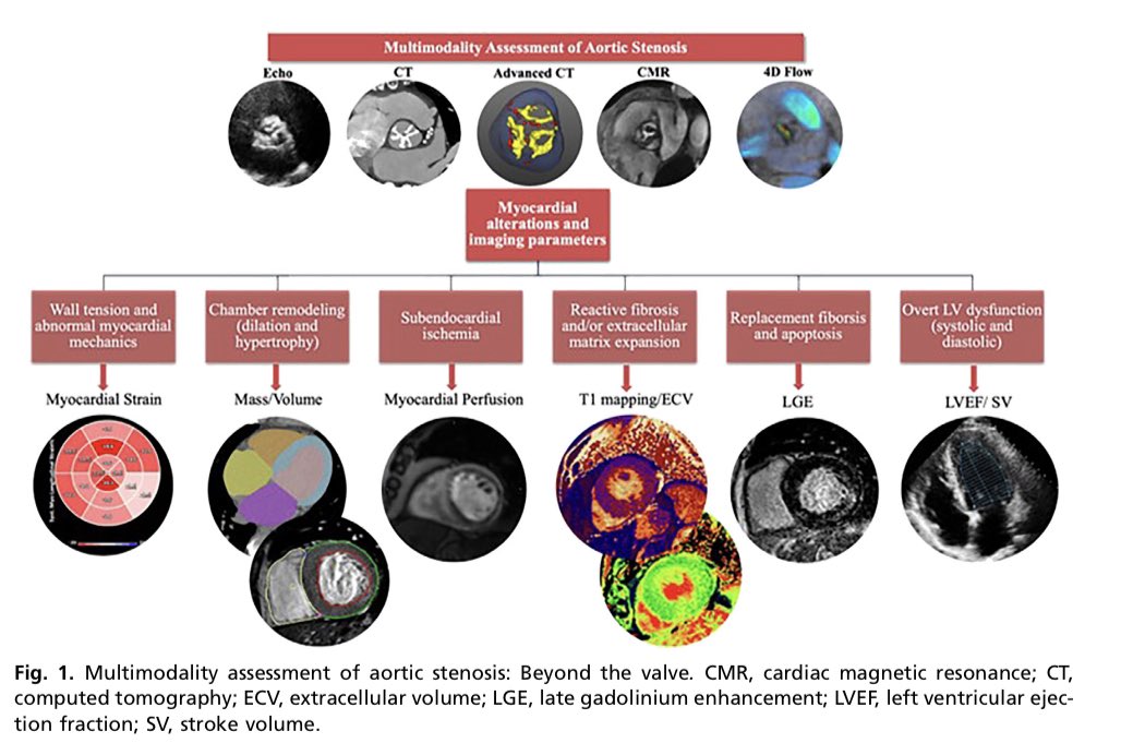 Ed_Alania's tweet photo. 🔴 Multimodality Imaging in Aortic Stenosis #CardioEd #Cardiology #CardioTwitter #echofirst #WhyCMR https://t.co/qAWq4xSKrx