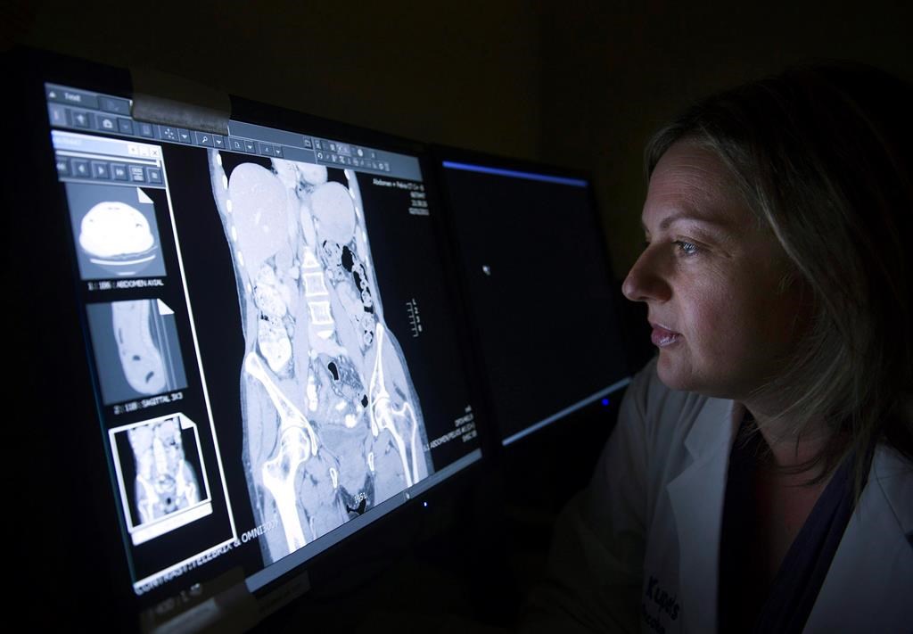 Des groupes réclament de meilleures données sur le cancer #enbeauce #société #santé #cancer #données bit.ly/3QadFoK