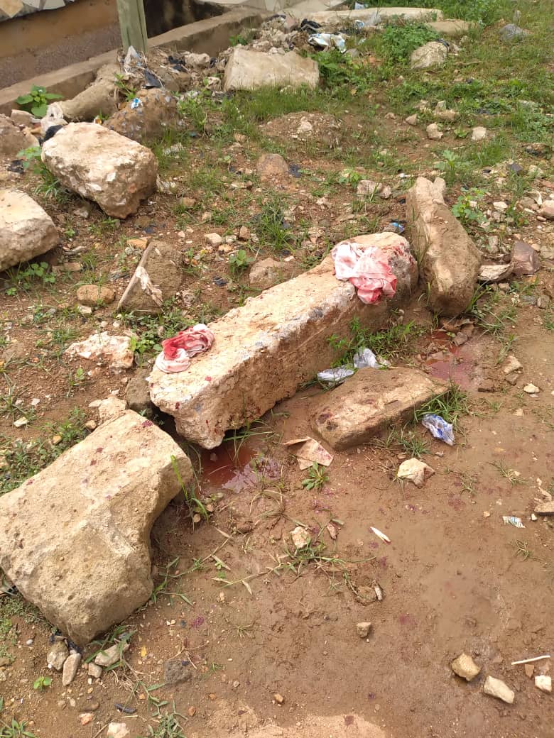 RightifyGhana's tweet photo. 🚨VIEW DISCRETION ADVISED

Man presumed to be gay attacked by violent men who stabbed him about six times

Few days ago, a man was attacked by two violent men near the Racecourse Medical Center at Sowutuom in Accra, Ghana, over his perceived sexual orientation

According to an... https://t.co/Uummw9i1nl