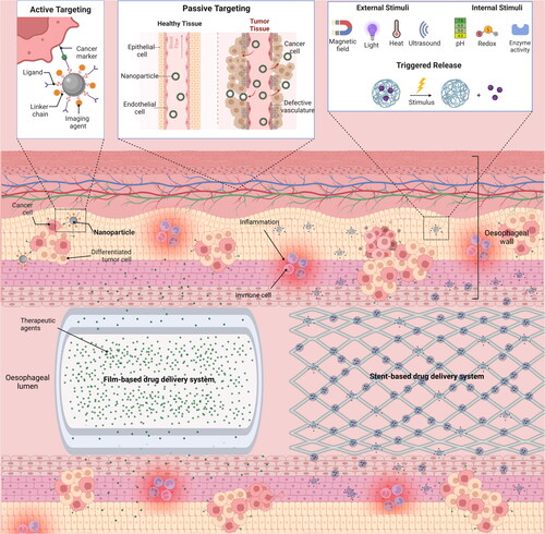 Susan Hua (@drsusanhua) on Twitter photo Extremely proud of my PhD student, Ai Wei Lim <a href="/QianXi11_24/">Qian Xi Lim</a>, for publishing her first paper from her PhD project "Current status and advances in esophagealĀ drug delivery technology: influence of physiological, pathophysiological and pharmaceutical factors" tandfonline.com/doi/full/10.10⦠Extremely proud of my PhD student, Ai Wei Lim <a href="/QianXi11_24/">Qian Xi Lim</a>, for publishing her first paper from her PhD project "Current status and advances in esophagealĀ drug delivery technology: influence of physiological, pathophysiological and pharmaceutical factors" tandfonline.com/doi/full/10.10ā¦