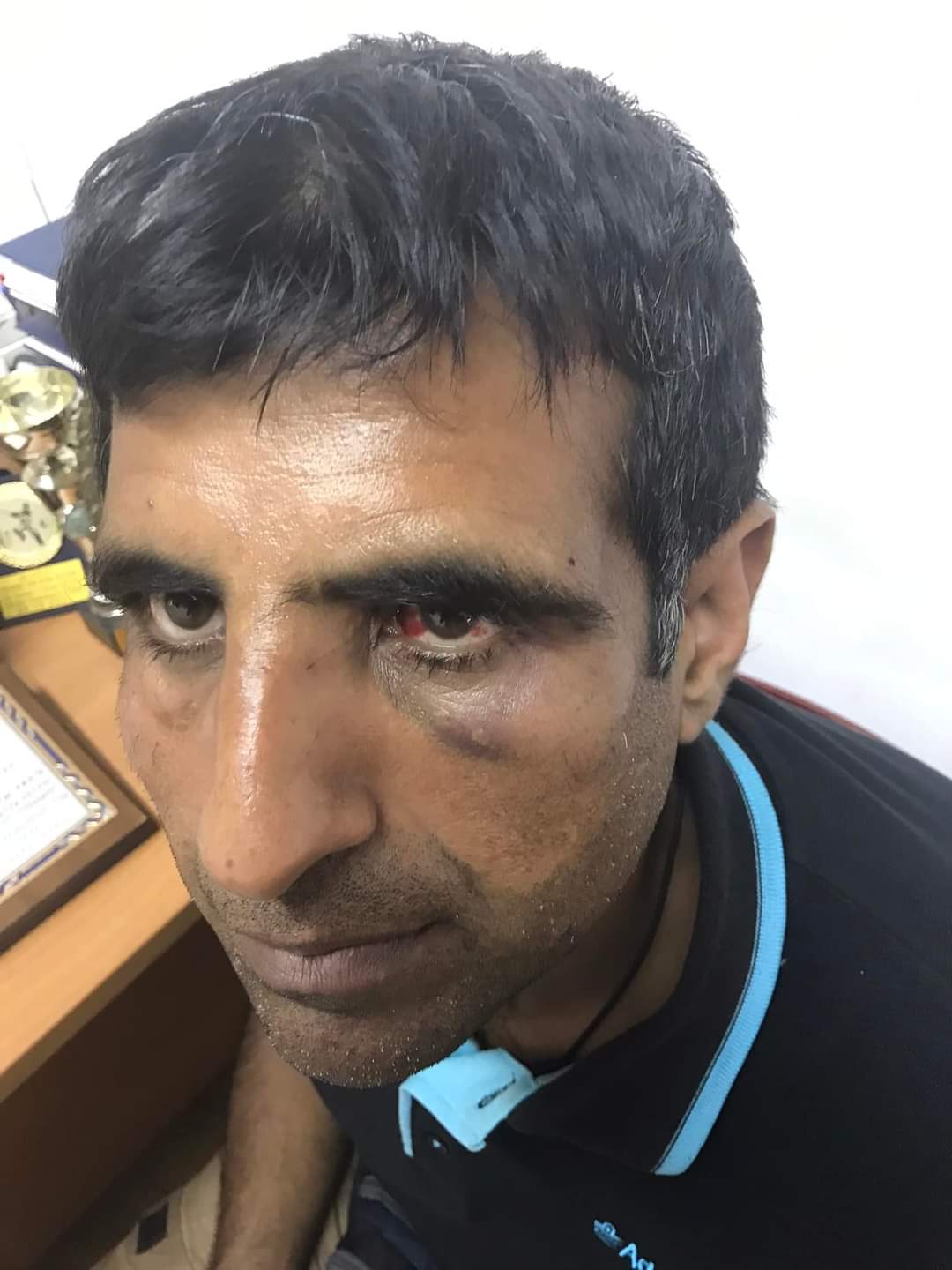 Vassilis Tsarnas on Twitter "Greece Nazir Ahmed, a 43yo migrant