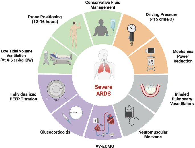 ABsteward's tweet image. 🆕️⚡️⚡️Narrative Review @Crit_Care
Management of severe acute respiratory distress syndrome: a primer #IDTwitter #CCTwitter #ARDS
ccforum.biomedcentral.com/articles/10.11…