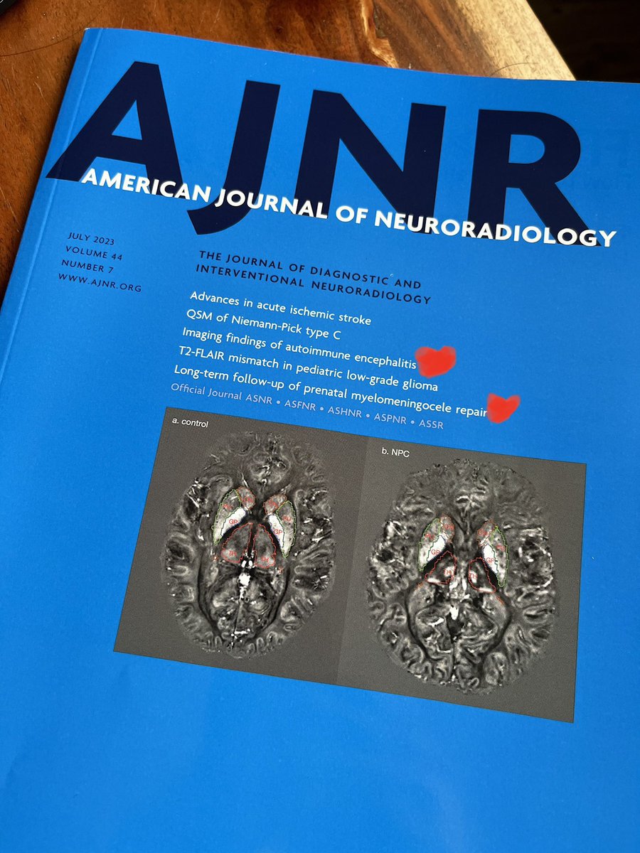 Wow, @UCSFimaging #pedsneurorad representing on the cover of the July issue of @TheAJNR I just got in the mail! Awesome articles from @YiLiMD and @LizzRad & Orit Glenn all in the same issue, what? #coolcolleagues @TheASNR