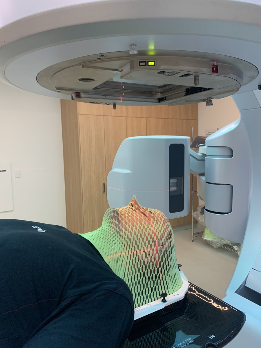 ProfRAScolyer's tweet photo. Now 1 wk in to daily radiotherapy treatment for my #glioblastoma. It’s going well! Will last 6 wks (60 Gray). Incredible advances in radiotherapy delivery over past 20 years! Integrating it with radiological guidance ensures v precise delivery &amp; even shaping 2 target! @AngelaHong https://t.co/7NyjKwsjpM